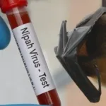 Virus Nipah Terdeteksi di India, Negara Asia Perketat Kewaspadaan